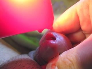 Urethra in hot red wax
