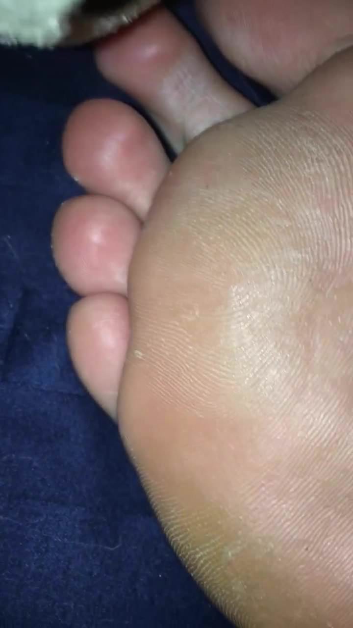 Smelly feet