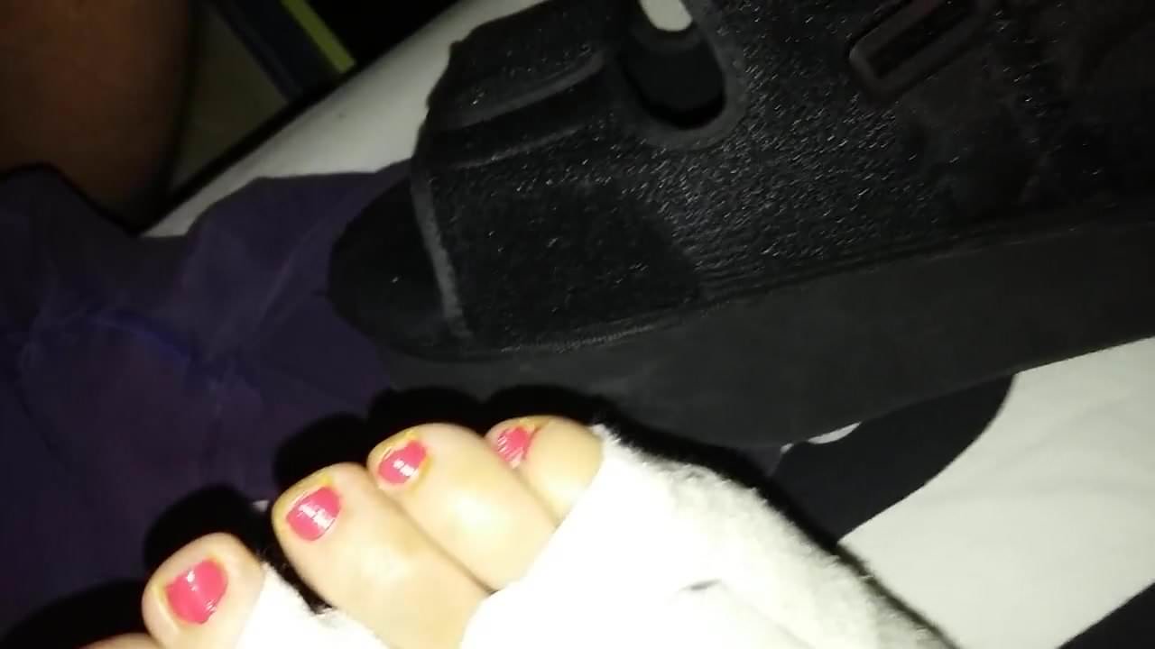 Masturbation and ejaculation near my wife's injured foot