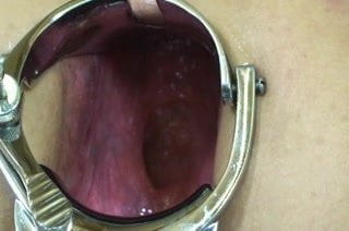 Elmer wife extreme anal speculum play